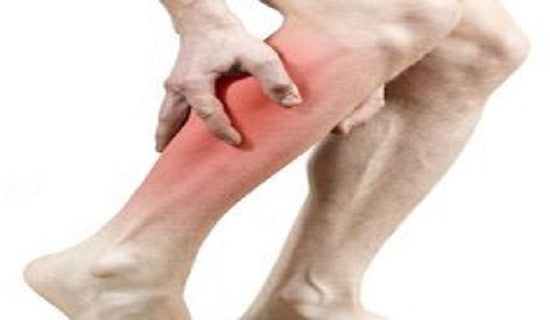 legcramps